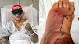 Dustin Poirier undergoes successful surgery on foot after infection causes readmission to hospital