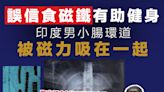 【切勿模仿】印度男誤信食磁鐵有助健身 小腸環道慘被磁力吸在一起