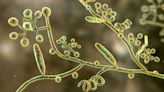 Rare fungal STI spotted in US for the 1st time