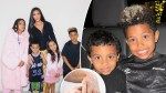 What is vitiligo? All about the disease affecting Kim Kardashian’s son