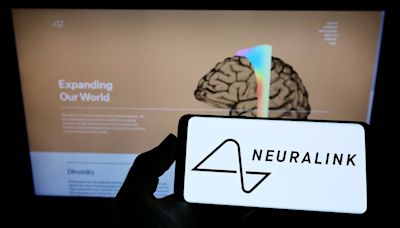 Implante cerebral de Neuralink falla: detectan problemas en el hombre al que le pusieron chip - El Diario NY