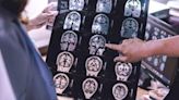 Could Brain ‘Overgrowth’ Contribute to Autism? | FOX 28 Spokane