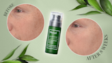 Murad’s Powerful New Retinal Serum Promises Firmer Skin Faster Than Ever — In 2-4 Weeks