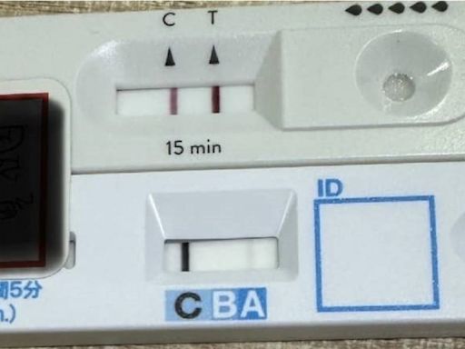 發燒喉嚨痛「醫1次驗2種快篩」！大哥笑問：甘欸加衰？ 結果曝光笑不出來了