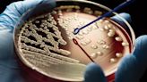 Antimicrobial resistance 'worse than climate change'