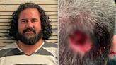 Florida man bit chunk out of deputy's head during assault at music festival: sheriff's office