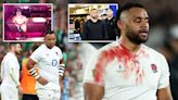Vunipola's public struggles with alcohol & injury that blighted his career