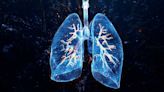 New drug tested offers room to breathe for patients with deadly lung disease