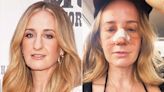 Why Country Singer Margo Price Got a Nose Job: 'I Was Bullied Online Constantly'