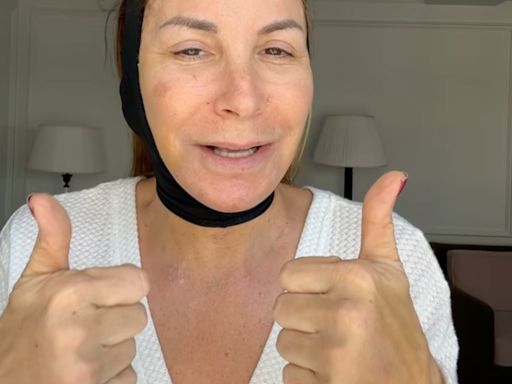 RHONY's Jill Zarin Reveals Why She Got a Facelift and Other Plastic Surgery Procedures - E! Online