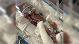 Micropreemie born to Idaho couple at 26 weeks is fighting for his life