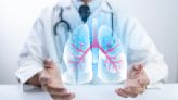 Severe Asthma Patients on Ways Their Doctors Could Improve Treatment