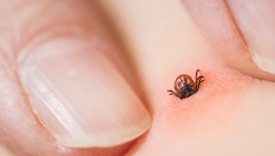 Tick season: What to know about Lyme disease as 'more resilient' ticks this year as parts of Canada see double-digit temperatures