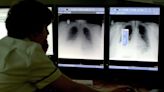 Top doctors warn shortage of NHS radiologists will rise to 40 per cent by 2028