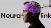 Neuralink: 85% dos fios se soltaram do cérebro do paciente que recebeu implante de Elon Musk | Mundo e Ciência | O Dia