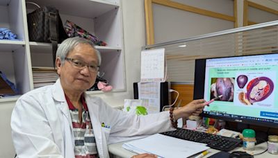 罕見子宮胎盤中風！ 35週孕婦緊急剖腹 胎死母救回 - 自由健康網