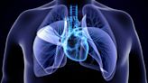 Study indicates mortality in rheumatic heart disease is high