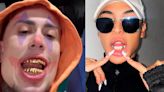 MC Daniel coloca prótese de ouro nos dentes; saiba valor e outros famosos que aderiram ao 'grillz'