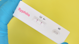 Number of syphilis cases in Colorado spikes