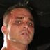 Teddy Hart