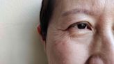 What Is Ptosis?