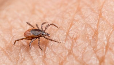 Scientists unexpectedly discover role human sweat plays in defense against Lyme disease: 'I'm excited, with caution'