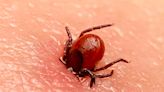 People in 8 states should be aware of the signs of yet another tick-borne disease as cases rise, CDC says