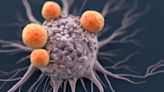 Researchers Create Novel Cell Type That Kills Cancer Cells in Research Models