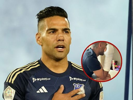 Aparece foto de Falcao con su mano fracturada y los hinchas de Millonarios sufren