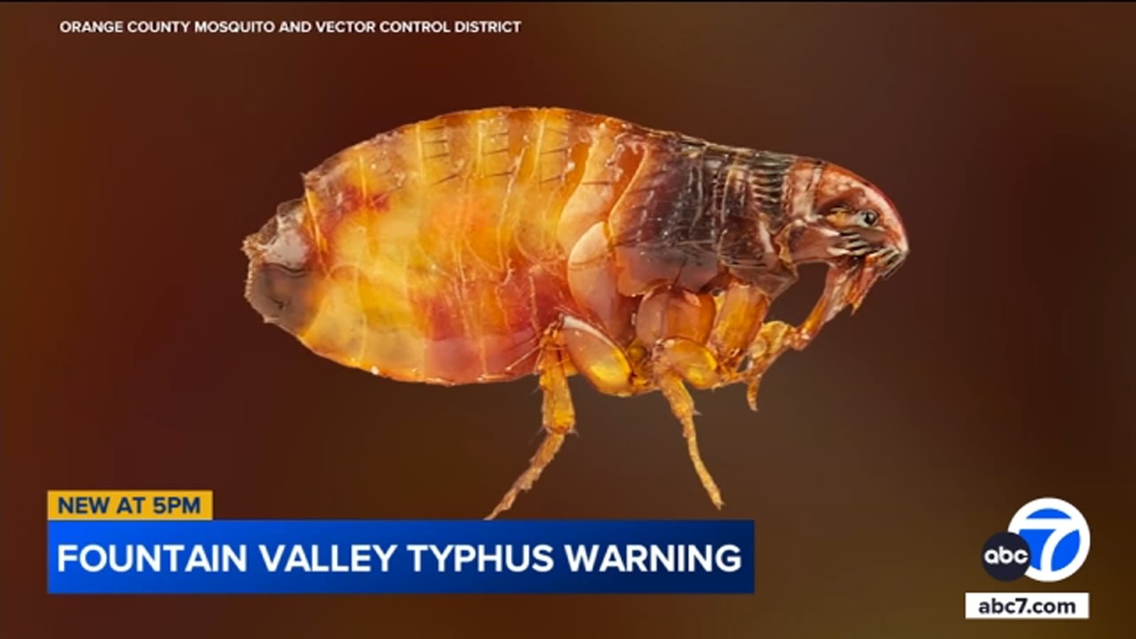 5th human case of flea-borne typhus reported in Orange County