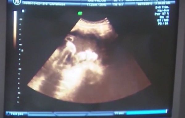 Governor DeSantis approves Florida's pregnancy, parenting website