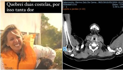 Luisa Mell se afasta de resgates de animais no RS após quebrar costelas: 'Podia ter perfurado um órgão'