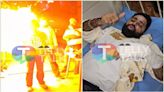 Sunny Aryaa AKA Tehelka Gets Injured In A Fire Accident, Wife Deepika Arya Escapes Injuries - Exclusive Video