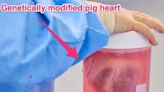 2 more gene-edited pig hearts were just successfully transplanted into humans — an early sign that pig transplants could really work