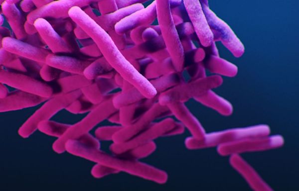 Tuberculosis outbreak declared public health emergency in Long Beach, but overall risk remains low, officials say