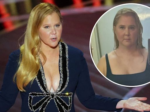 Amy Schumer habló sobre su “rostro hinchado” y su diagnóstico de Síndrome de Cushing