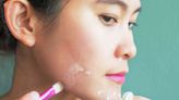 How to Cover Up a Pimple Like a Pro: Step-by-Step Guide