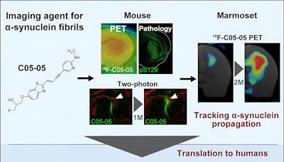 Visualizing core pathologies of Parkinson's disease and related disorders in live patients