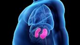 Sleeve Gastrectomy Improves Kidney Transplant Rates