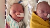 Hospital sees high number of twin births