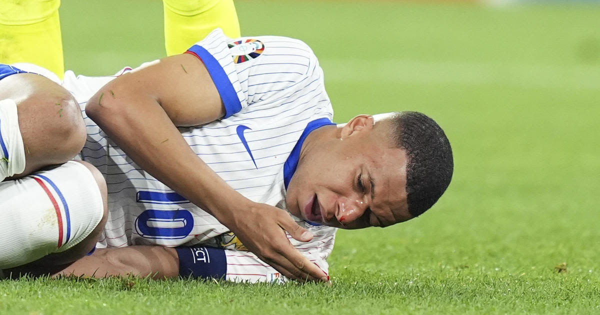 Broken nose to force France's soccer star Kylian Mbappé to wear a mask if he carries on in UEFA championship