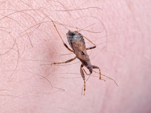 España se propone acabar con la transmisión del Chagas de madre a hijo con un cribado para las embarazadas “en riesgo”