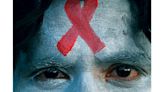 Our country's dark history of persecuting people with HIV