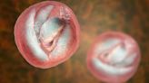 Diarrhoea bug found in new 'parasite hotspots' as cryptosporidium cases hit 77