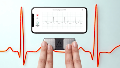 This 'tiny lifesaving device' gives you ECG readings at home — it has over 71,000 reviews