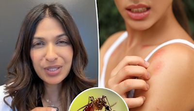 I’m a doctor — this is the easiest way to heal mosquito bites fast