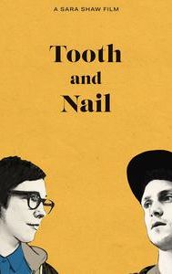 Tooth and Nail