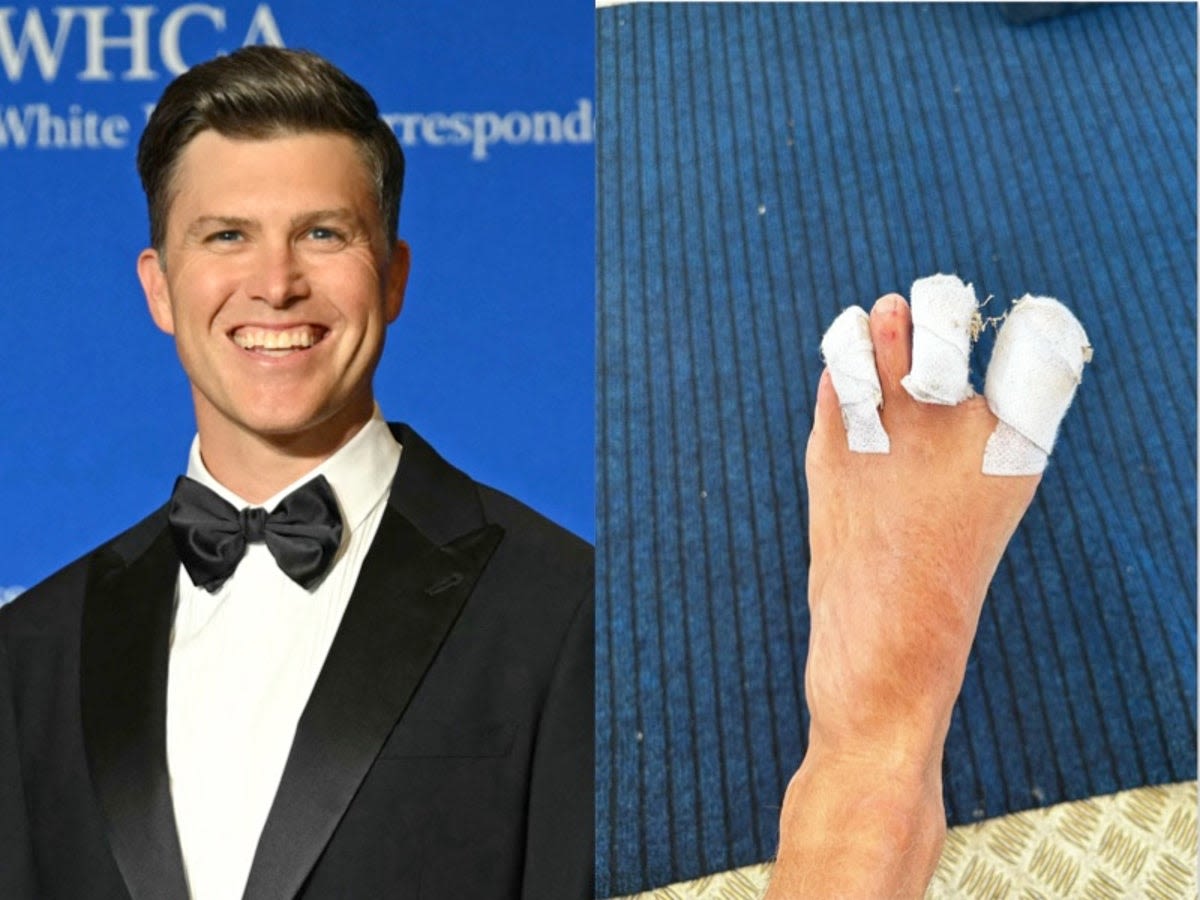 Colin Jost shares photo of bloodied foot injury while covering Olympic surfing in Tahiti