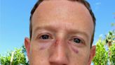 Mark Zuckerberg Got Busted in the Face