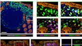 Cell types and molecules usually associated with autoimmune diseases found to be normal components of gut immunity